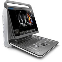 УЗИ-аппарат Chison SonoTouch 60
