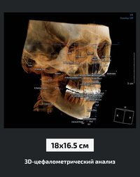Дентальный томограф КТ Зубов DENTRI новый Корея 