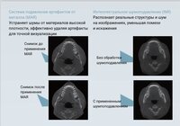 Finscan новый томограф клкт дентальный 2026