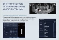 Finscan новый томограф клкт дентальный 2026