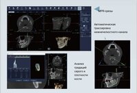 Finscan новый томограф клкт дентальный 2026